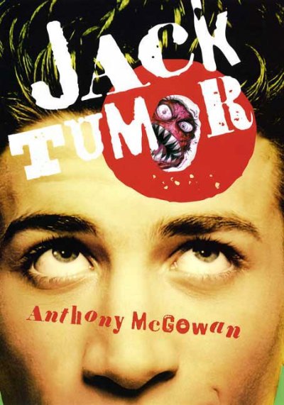 Jack Tumor / Anthony McGowan.